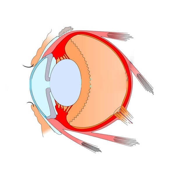 Retina Specialist-Age
                    Related Macular Degeneration